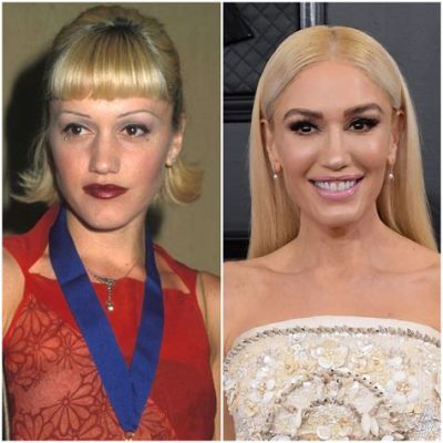 Did Gwen Stefani Get Plastic Surgery? Exploring the Melody of Transformation